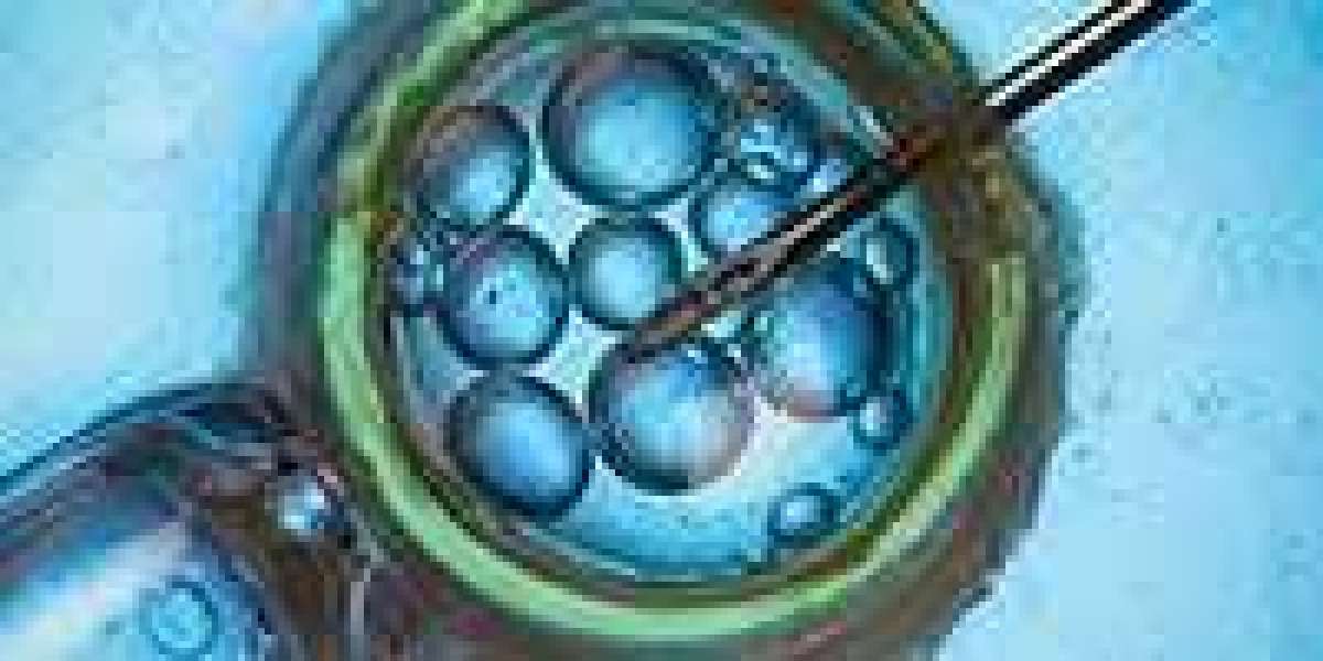 In Vitro Fertilization Market Expected To Reach $987 Million By 2026