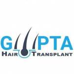 GUPTA HAIR Transplant